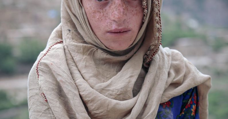 Authenticity - Portrait of a Boy with Freckles, Wearing a Headscarf